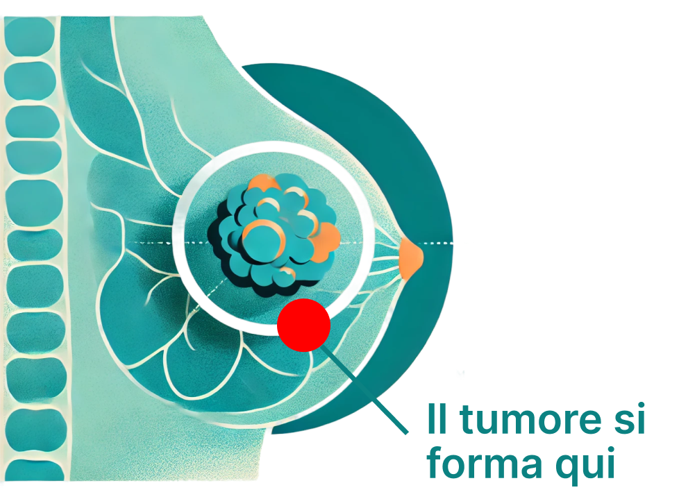 Mai Più Sole - Tumore al Seno